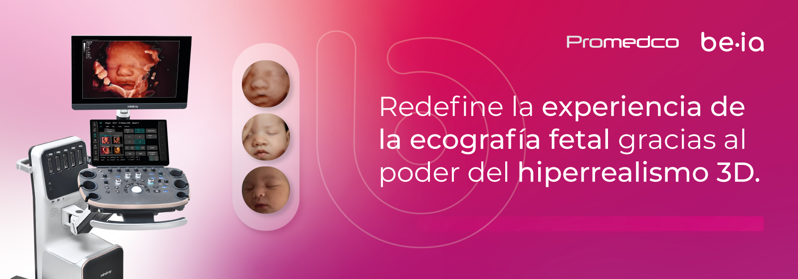 BEIA: experiencia ecográfica hiperrealista