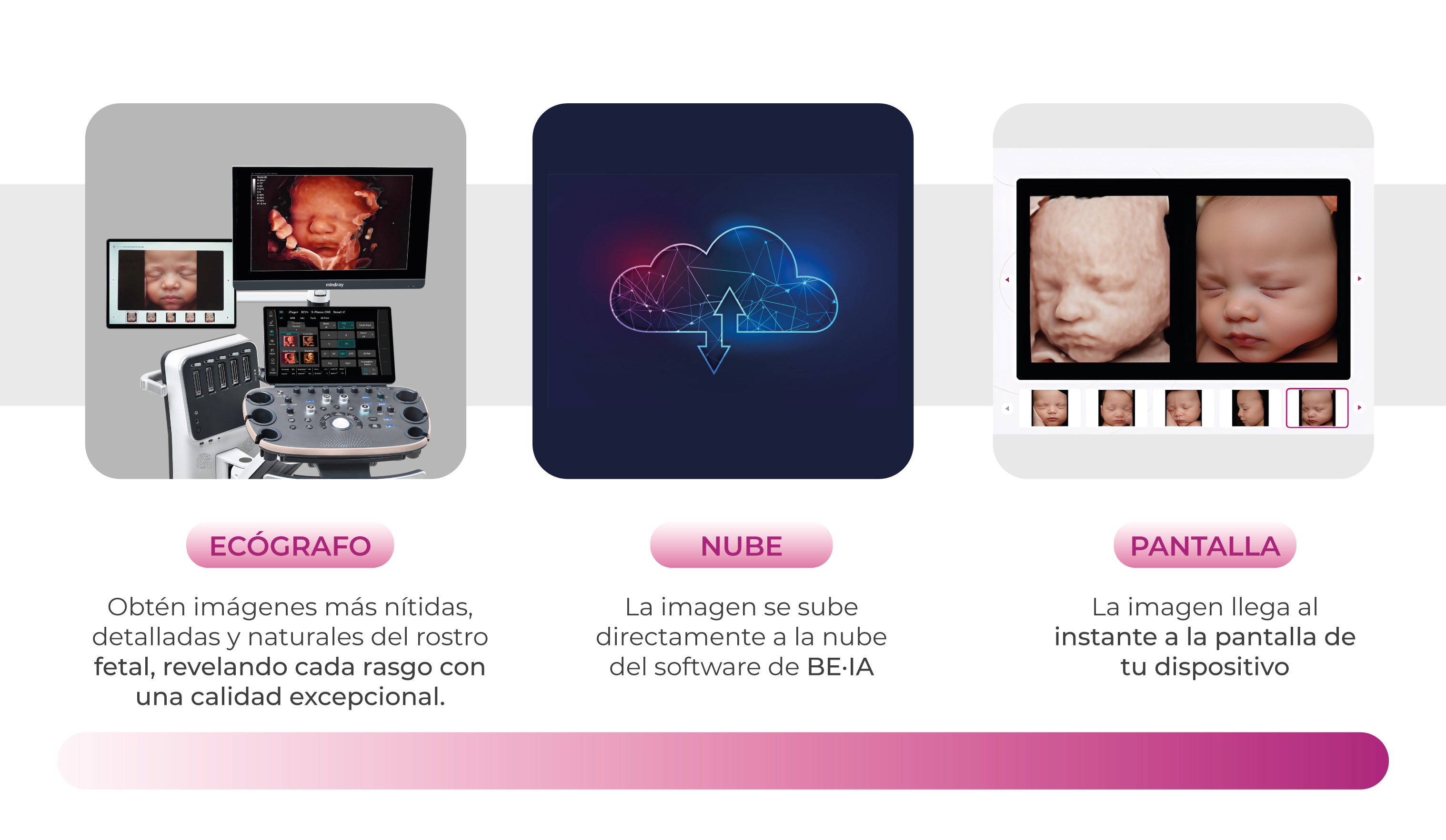Flujo BEIA: ecógrafo, nube y pantalla para obtener imágenes hiperrealistas