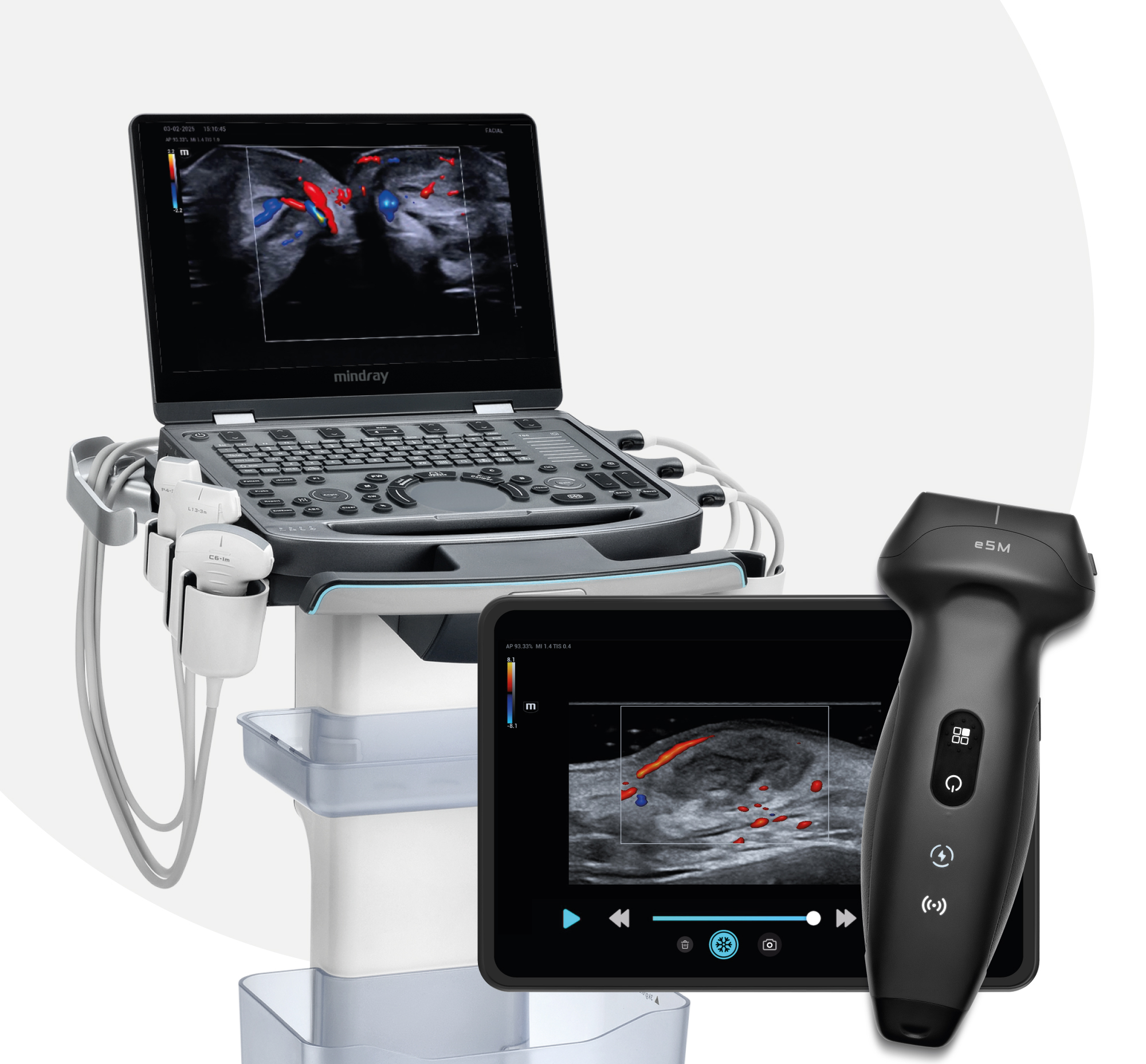 Equipos Mindray MX3 y TE Air